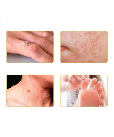 Bee Venom Skin Treatment Cream Fast-Acting & Gentle Care for All Skin Types (30ml) | Advanced Skin Therapy - Buy Online on GoSupps.com