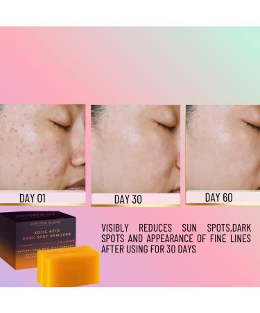 JUPITERS BLOOM Kojic Acid Dark Spot Remover Soap Bars - 2 Pack with Vitamin C Collagen Retinol & Turmeric - Original Japanese Formula - Buy Online on GoSupps.com