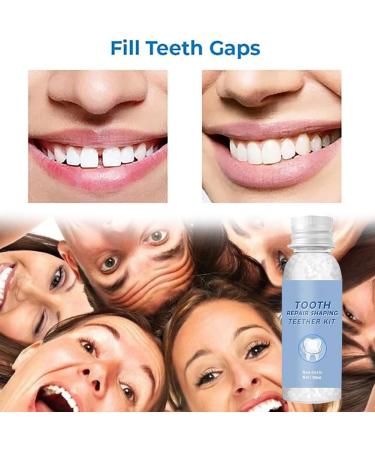 Premium Temporary Denture Set - DIY Heat Fit Beads for Easy Tooth Restoration | Replacement Prosthesis - Buy Online on GoSupps.com