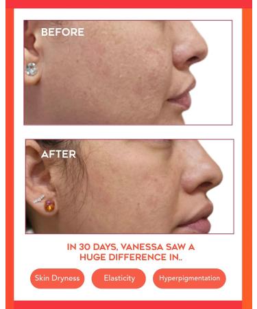 bejou Hydrating Dew Moisturizer with Chontaduro Natural Retinol Alternative Sensitive Skin Formula for Dark Spots Normal to Dry Skin Anti-Aging Face Cream Blue Light Protection 1.7 Fl Oz - Buy Online on GoSupps.com