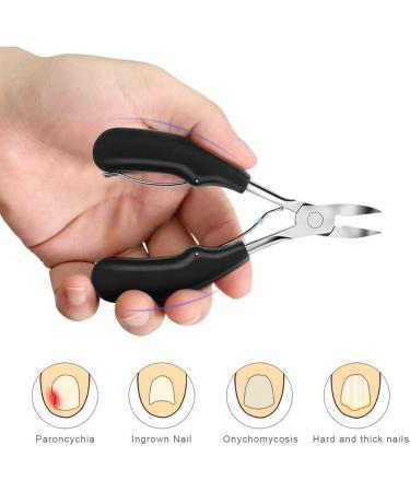 Toe Nail Clipper - Stainless Steel Toenails Trimmer | 5-Piece Painless Toenail Treatmentt Tools | Comfortable Toenail Clippers for Ingrown Toenail Care General Nail Care Preventing Infectionn - Buy Online on GoSupps.com