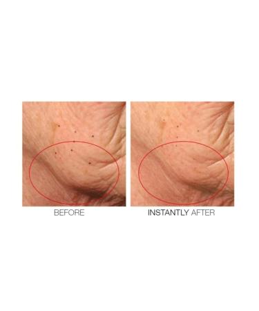 Mirenesse Cosmetics Chin Tuck V Shape Lifting Serum - Lift and Firm Your Jawline - Buy Online on GoSupps.com