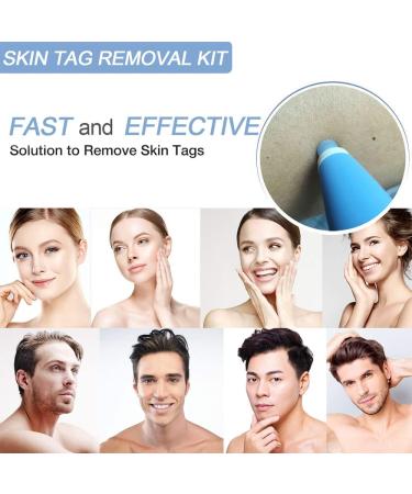 Remove Skin Tag Pen Facial Care Nevus Tool 2mm-4mm Remove Meat Nevus Corns Warts Skin Tag Removal Tool GLFA - Buy Online on GoSupps.com
