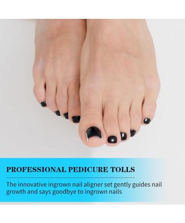 Buy 50+1 Pcs Ingrown Toenail Treatment Kit - Professional Pain-Free Correction & Removal Set for Men & Women - Buy Online on GoSupps.com