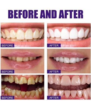 SP-5 Toothpaste WE2C Teeth SP-5 Whitening Toothpaste SP-5 Whitening Toothpaste Fresh Breath Toothpaste Promotes Healthy Teeth and Gums (Red+Red) - Buy Online on GoSupps.com