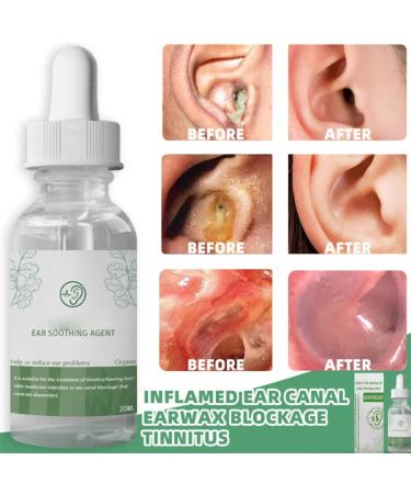 Pofeiya ARSICOR Organic Herbal Drops - Stop Ear Ringing & Hearing Loss, All Natural Ear Soothing Agent, 2Pcs - Buy Online on GoSupps.com