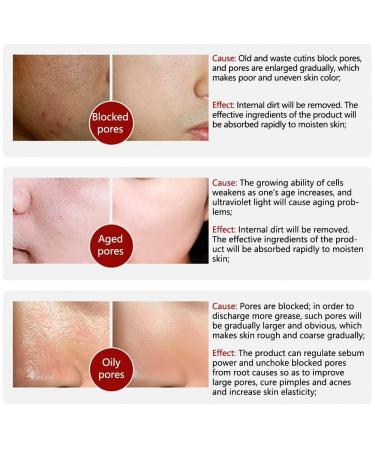 LANBENA Pore Skin Care Serum Facial Essence Minimize Enlarged Pores for Tightening Pores Shrinking Pores + Relieving Dryness + Oil Control Firming + Moisturizing (New Packing) - Buy Online on GoSupps.com