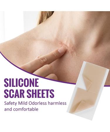 Silicone Scar Sheets Roll 1.6 x 60 - Waterproof Reusable Silicone Strips for C-Section Surgery, Burns, Injuries, Acne, Stretch Marks - Breathable Scar Tape for Skin Patch Away - Buy Online on GoSupps.com