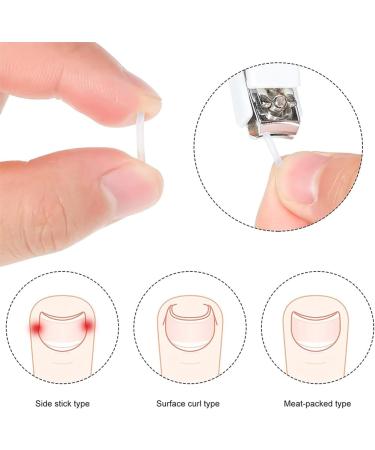 30 Pieces Ingrown Toenails Feet Ingrown Nail Set Ingrown Nail Lifter Ingrown Toenail Corrector Ingrown Toenail Toenails for Foot Thicknesses (Transparent) - Buy Online on GoSupps.com