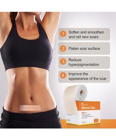 Medical Grade Silicone Scar Tape Roll - Postpartum Belly Band for Scars, Keloids, Burns & Thyroid - 1.6 x 60 | Effective Scars Removal Solution - Buy Online on GoSupps.com