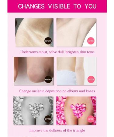 Whitening Cream Body Cream Neck Sensitive Areas Elbows Thighs Knees Body Underarms Whitening Cream - Buy Online on GoSupps.com