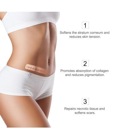 3Meters Silicone Scar Roll for C-Section Surgery Burn Keloid Acne - Drug-Free Professional Scar Sheets - Buy Online on GoSupps.com