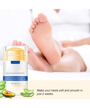 01 Urea Foot Care Cream 40 g for dry skin urea foot cream ideal for rough and very dry feet moisturizing and crackfree foot cream foot cream for calluses - Buy Online on GoSupps.com