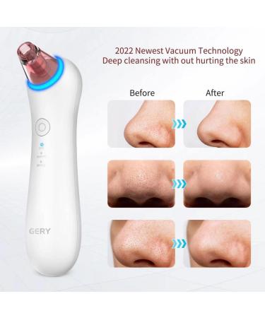 2023 Newest GERY Blackhead Remover Pore Vacuum Extractor Kit | Facial & Nose Peel Tool with Red&Blue Light | Electric Comedone Acne Extractor | 4 Probe Set - Buy Online on GoSupps.com