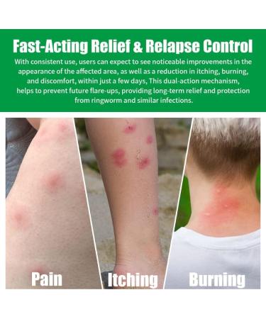 Tea Tree Oil Balm 1.76oz - Extra Strength Itch Relief Cream for Heat Rash, Tinea Versicolor, Butt Rash, Jock Itch & More - Non-irritating Formula for Men, Women, Kids, Adults - 50g - Buy Online on GoSupps.com