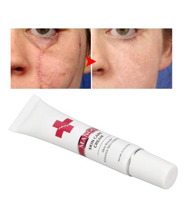 Nourishing Plant Based Scar Cream for Safe & Gentle Scar Repair - Buy Online on GoSupps.com