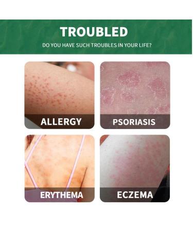 Chinese Herbal Psoriasis Cream - Natural Skin Ointment for Psoriasis Relief - Buy Online on GoSupps.com