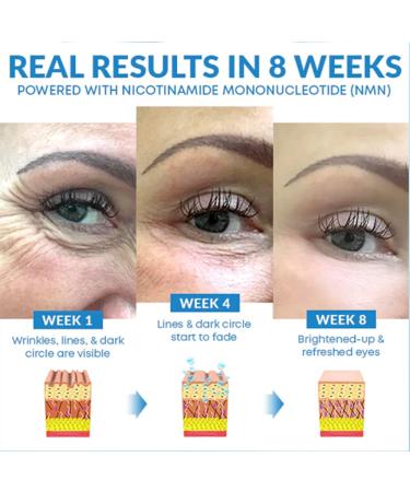 VCHICBP Hyakuon Hydro Pro Youthrestore Hyaluronic Acid Eye Cream (2) - Buy Online on GoSupps.com