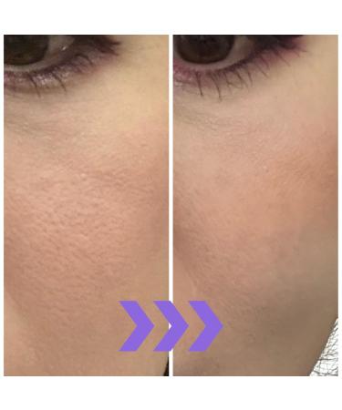 MizumaRi Age-Defying Serum | Smooths Texture Firms & Restores Radiance | Fragrance-Free Japanese Formula - Buy Online on GoSupps.com