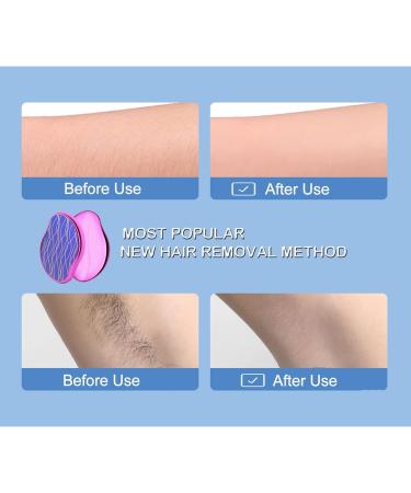 Crystal Hair Eraser Painless Hair Removal Tool Magic Nano Crystal Hair Eraser Painless Hair Remover for Men & Women Physical Epilator Apply to Any Part of Body Fast & Easy Hair Removal (Rose) - Buy Online on GoSupps.com