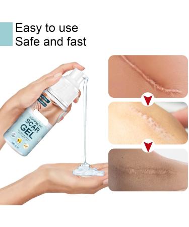 2Pcs 50ml Scar Gel with Allantoin & Vitamin E - Hydrate, Renew, Smoothing Stretch Marks Remover for Burn Surgery - Buy Online on GoSupps.com