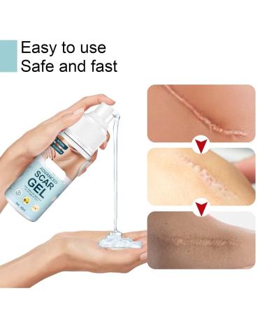 Stretch Mark Gel 2Pcs 50ml with Allantoin & Vitamin E - Hydrating Scar Remover for Scars, Burns & Surgery - Buy Online on GoSupps.com