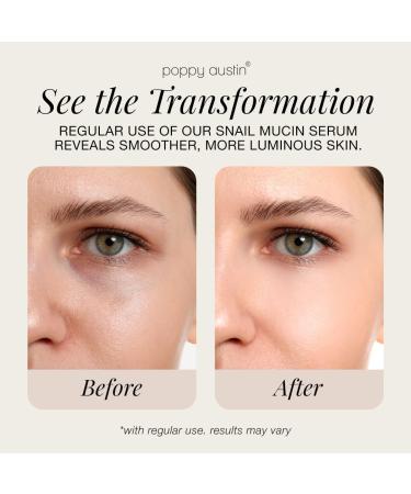 96% Snail Mucin Serum with Niacinamide, Snail Serum for Face, Hydrating Serum Snail Mucin Essence Face Serums for Anti Aging Serum (3.34 Fluid Ounces) 3.34 Fl Oz (Pack of 1) - Buy Online on GoSupps.com