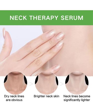 Neck Firming Cream Tighten and Lift Neck Cream Neck Line Remover Neck Tightening and Firming Vitamin C Vitamin E Moisturizing Anti Aging Reduce Neck Fine Lines Improve Roughness - Buy Online on GoSupps.com