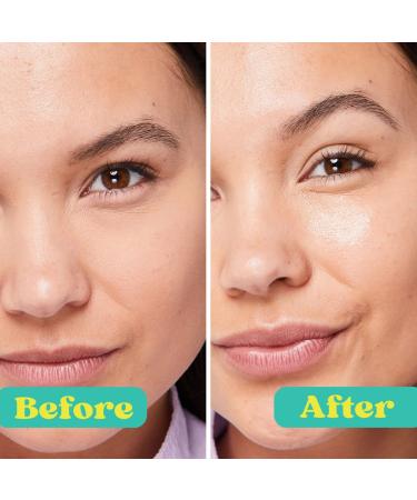 Patchology Skin Care Kit - Serve Chilled Eye Masks for Dark Circles & Puffiness | Spa Day Essentials with Niacinamide & Hyaluronic Acid | Ideal for Bachelorette Party Favors - Buy Online on GoSupps.com