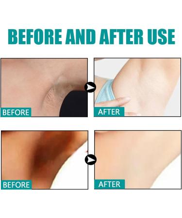  JPSDOWS axillary cream for armpits brightening underarms for hyperpigmentation | brightening armpits whitening cream for skin brightening cream for body care moisturizing concealer for Jpsdows - Buy Online on GoSupps.com