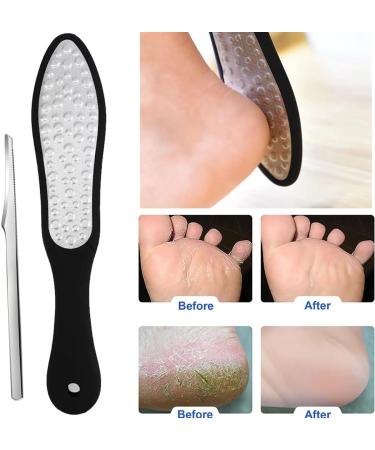WHYCNJL 1 Piece Professional Foot Rasp with 1 Piece Pedicure 304 Callus Remover in Stainless Steel Removes Calluses of Dead and Wrinkled Skin Portable Stainless Steel Foot Care - Buy Online on GoSupps.com