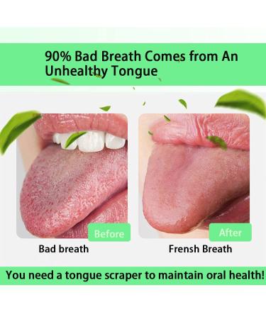 Bonmall Stainless Steel Tongue Scraper (2-Pack) with Carry Case | Tongue Scraping Brush for Fresh Breath | Oral Hygiene Care | Rose Golden - Buy Online on GoSupps.com