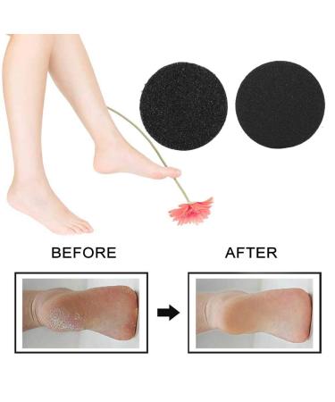 60pcs Foot File Replacement Sandpaper Discs for Electric Callus Remover - Smooth Feet & Easy Care - Buy Online on GoSupps.com
