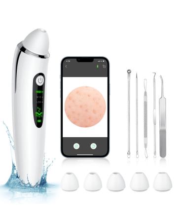 Blackhead Remover Pore Vacuum, Electric Facial Deep Cleaner, USB Rechargeable Male and Female Acne Whitehead Extraction Tool, 6 Suction Heads & 3 Adjustable Suction