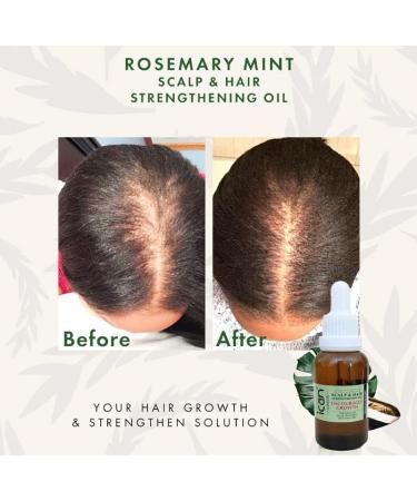 ican London Rosemary Mint Scalp & Hair Treatment Oil For Faster Hair Growth 30ml - Buy Online on GoSupps.com
