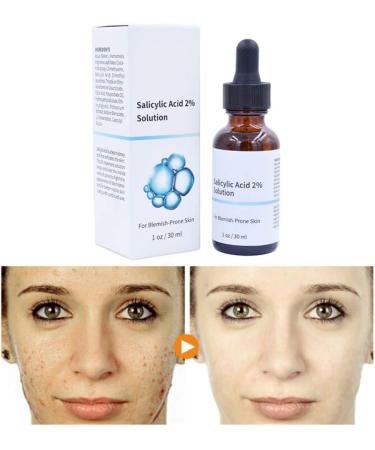 Salicylic Acid Concentrate Super Strong 2% - Acne Spot Treatment - Professional Skincare Serum White 1 - Buy Online on GoSupps.com