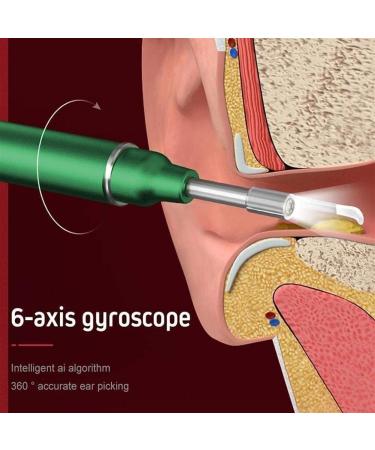 NAUTIG Ear Wax Removal Tool Camera - Safe Non-Detachable Ear Scoop Kit for Earwax Removal - Luminous Ear Picking Device - Buy Online on GoSupps.com