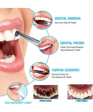 Electric Dental Calculus Remover - Portable Sonic Tartar Stain Plaque Cleaner for Teeth - Teeth Cleaning Kit - Buy Online on GoSupps.com