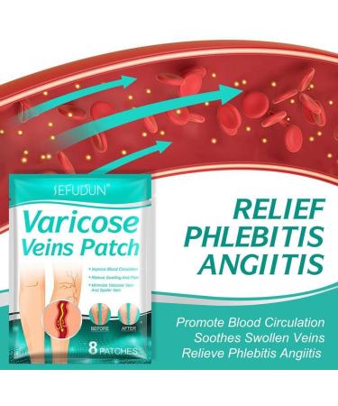 Wmool 8-Piece Varicose Veins Treatment | Vasculitis & Phlebitis Relief | 24 Sheets for Venous Fatigue & Limb Stiffness - Buy Online on GoSupps.com