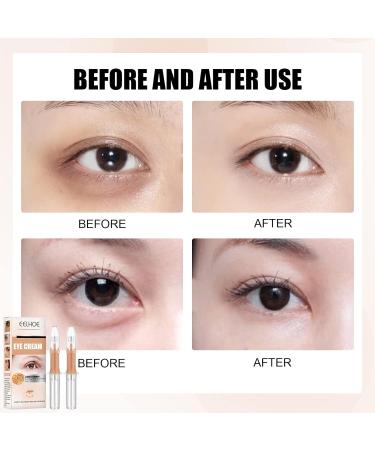 ICOVOIY 1 Min Eyes Beauty Serum - Anti-Aging Eye Cream for Dark Circles & Puffiness (3PCS) - Buy Online on GoSupps.com