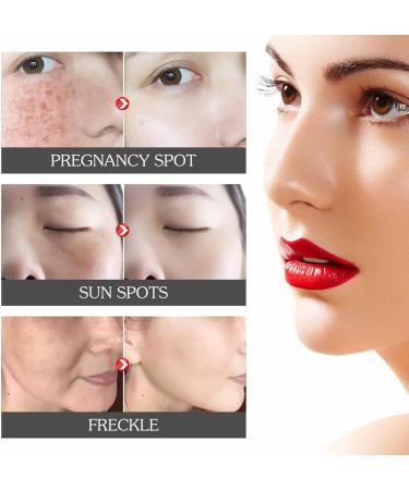  Hongjingda Turmeric - Liquid Dark Spot Removal | 1.01 FL oz Rejuvenating Skin Care for Women Moisturizes Dull and Dry Skin - Buy Online on GoSupps.com