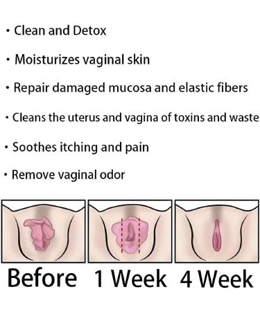 AnnieCare Anti-Itch Detox Slimming Firming Repair Capsules - 4 Boxes, 28 pcs - Tightens, Removes Odor, Reverts to Tight & Tender State - Buy Online on GoSupps.com