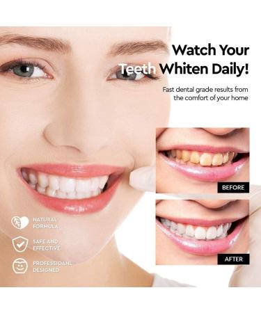 Teeth Whitening Gel - DOUCEUR Whitening Pen (2 Pcs) | Effective Painless No Sensitivity & Travel-Friendly - Buy Online on GoSupps.com