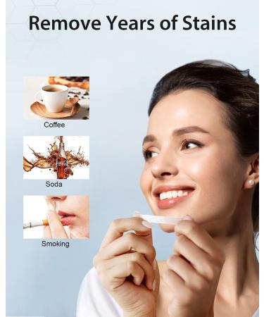 MySmile Teeth Whitening Strips - Non-Sensitive Kit, 28 Sets for 10 Shades Whiter, Removes Stains from Coffee, Wine & More - Buy Online on GoSupps.com