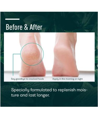 Ellocy Urea 42% Foot Cream with Salicylic Acid - 4.2 oz - Best Callus Remover for Thick, Cracked, Rough, Dead & Dry Skin - Moisturizes and Rehydrates Feet - Buy Online on GoSupps.com
