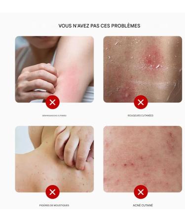  G n rique Anti-Itch Cream - Soothing Care 20g | Fast-Absorbing Balm for Combination Oily and Sensitive Skin - Post-Sports Recovery - Buy Online on GoSupps.com