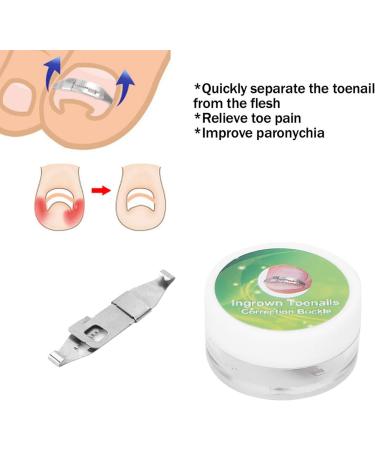 Ingrown Toenail Treatment Stainless Steel Ingrown Toenail Corrector Relief Paronychia Treatment Correcting Tool - Buy Online on GoSupps.com