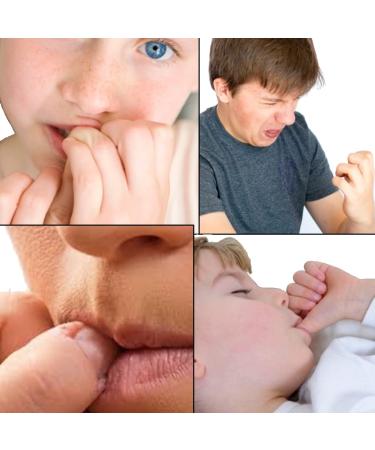 Honest 10 Nail Biting Treatment | Strongest Formula for Kids and Adults | 10-Free, Safety Tested, Dries Clear | 0.25 Ounce (Pack of 1) - Buy Online on GoSupps.com