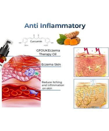 GFOUK Eczema Therapy Spray All Natural Eczema Treatment Psoriasis Treatment Skin Care Pain & Itch Spray Fast Acting Itch Relief (3PC) - Buy Online on GoSupps.com