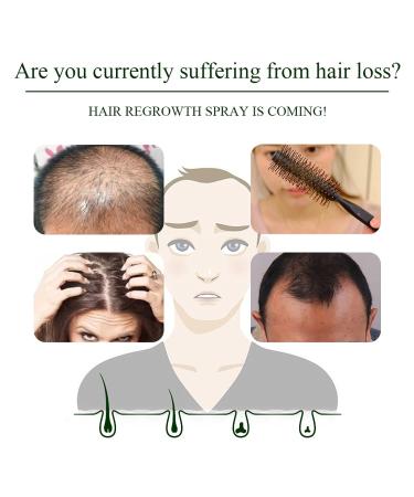 Serum Hair Growth - Accelerate Ginger Growth | Anti-Hair Failure | Strengthens Roots | 20ml for Men & Women - Buy Online on GoSupps.com